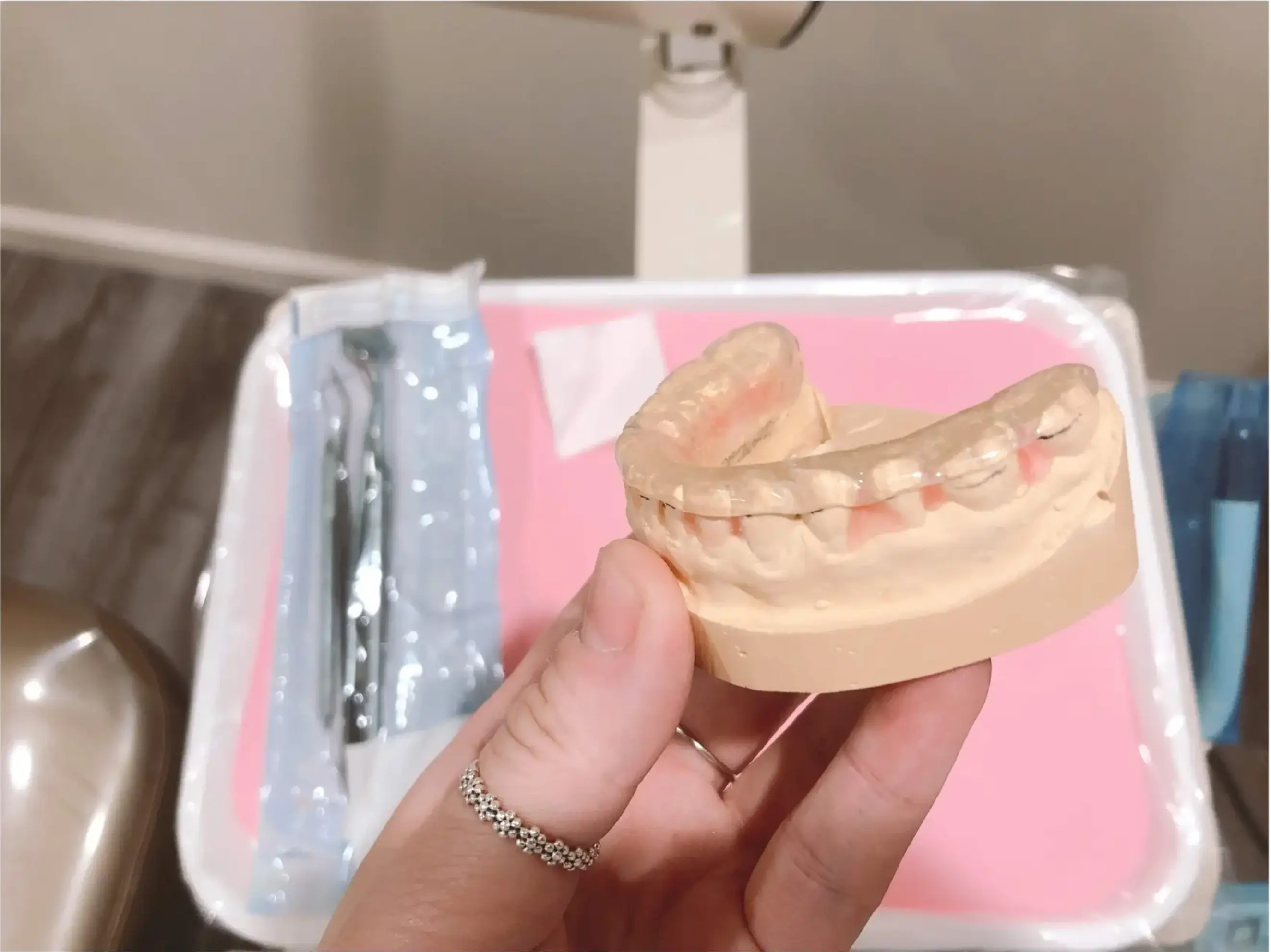 Dental model with a clear night guard, showing how teeth can be protected from clenching and grinding.